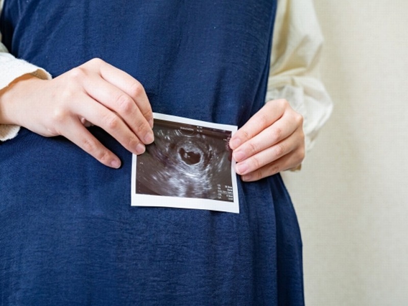 お腹の赤ちゃんのエコー写真と妊婦さん