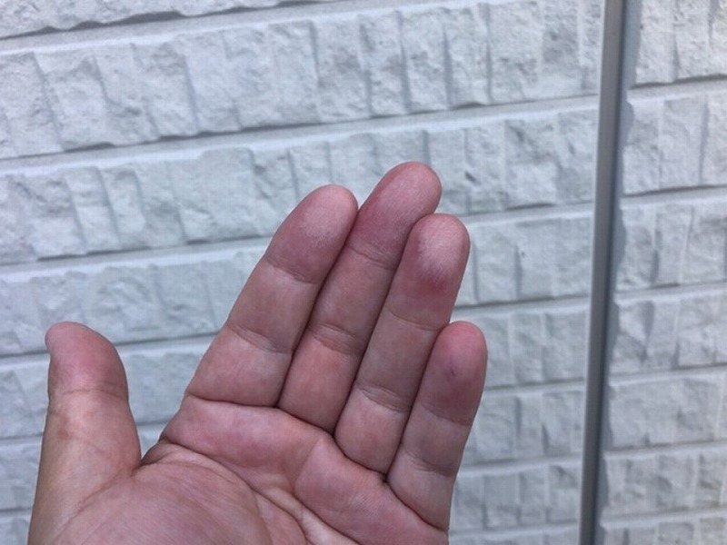 チョーキング現象